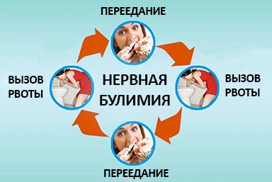 Лечение булимии в Городище
